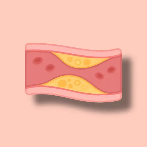 콜레스테롤